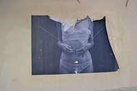 Collage réalisé par Marion Jaillot, figurant de manière autobiographique une femme atteinte d’un cancer, représentée en sous-vêtements, laissant paraître une cicatrice ventrale (Montpellier)
